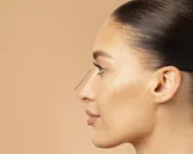 Perfil feminino (pós-operatório de rinoplastia)