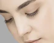 Rosto feminino sereno (pós-operatório da rinoplastia)
